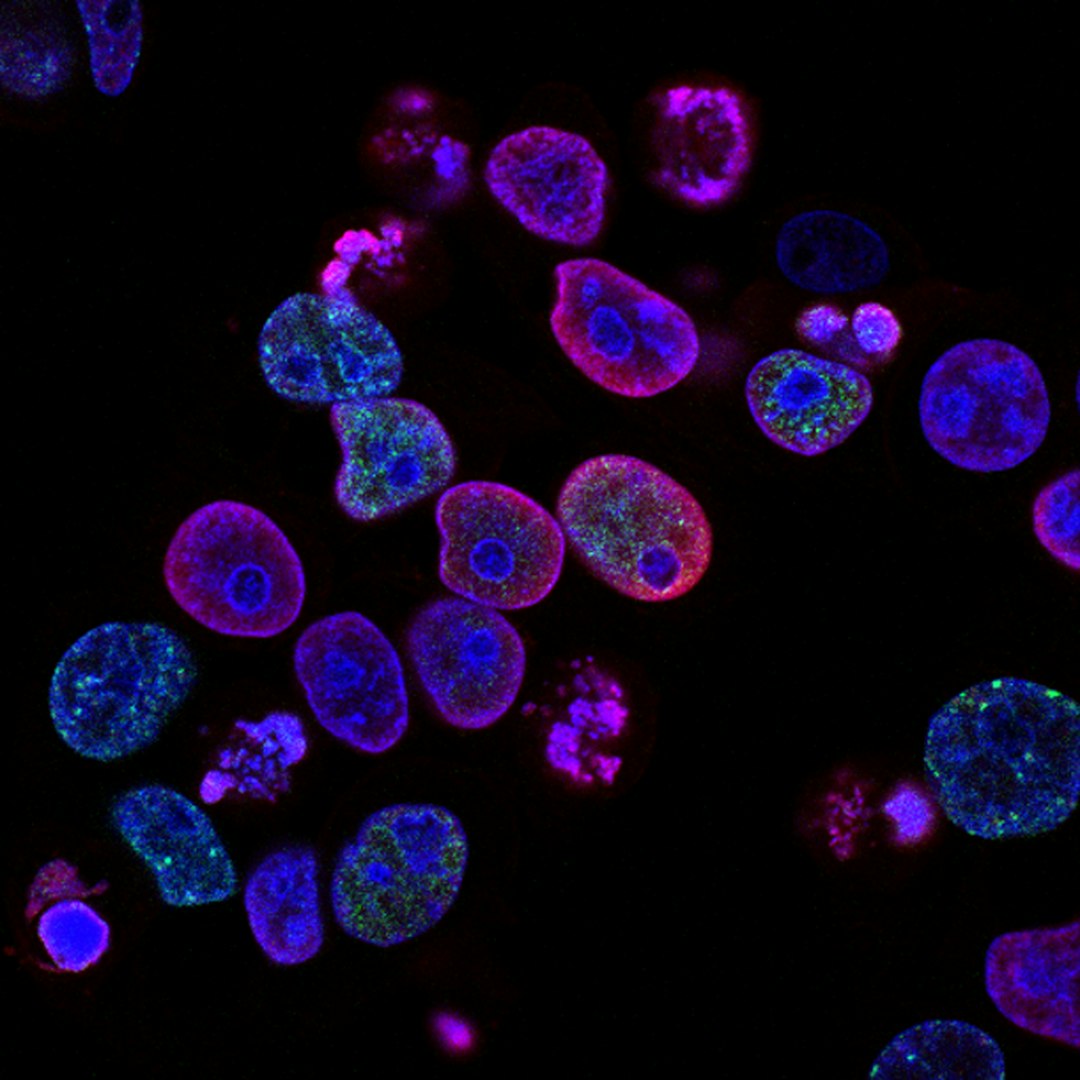 The Impact of Genetics on Life Expectancy: Unveiling the Secrets